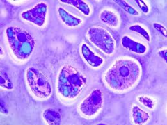 chondrocytes chondrocytes