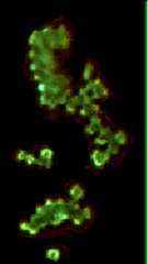 cocci cocci