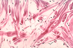 connective tissue connective tissue