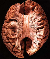 corpus callosum corpus callosum