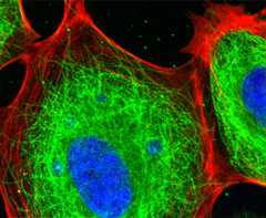 cytoskeleton cytoskeleton