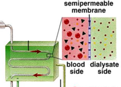 dialysis dialysis