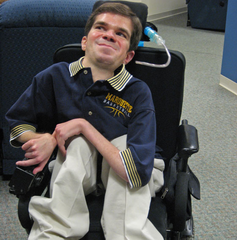 Duchenne muscular dystrophy Duchenne muscular dystrophy