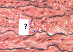 elastic fibers elastic fibers