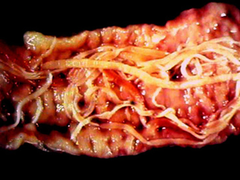 endoparasites endoparasites
