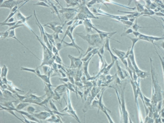 fibroblasts fibroblasts