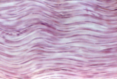 fibrous connective tissue fibrous connective tissue