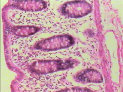 glandualar epithelia glandualar epithelia
