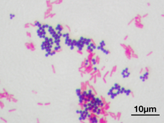 Gram stain Gram stain