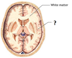 grey matter grey matter