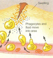 inflammtory response inflammtory response