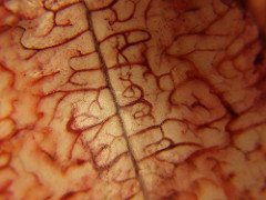 medulla medulla