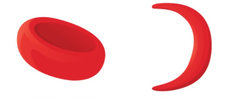 sickle-cell disease sickle-cell disease