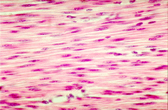 smooth muscle smooth muscle