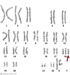 trisomic trisomic