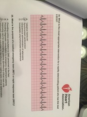 What is the most appropriate intervention for a rapidly deteriorating patient who has this lead II ECG? What is the most appropriate intervention for a rapidly deteriorating patient who has this lead II ECG?